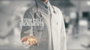 Mechanics of Stem Cell Therapy in California