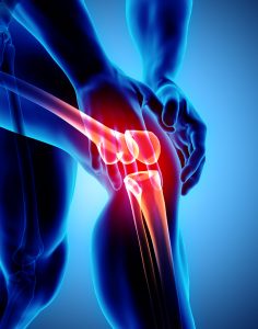 knee pain treatment Beverly Hills