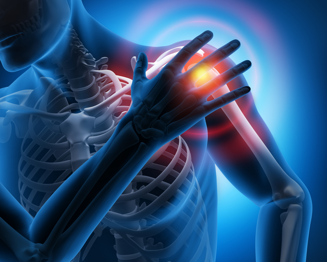 STEM CELL TREATMENT FOR CHRONIC SHOULDER PAIN Advanced Stem Cell